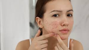 Everyday-Habits-That-Ruin-Your-Skin