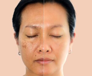 How-to-Protect-Your-Skin-moi