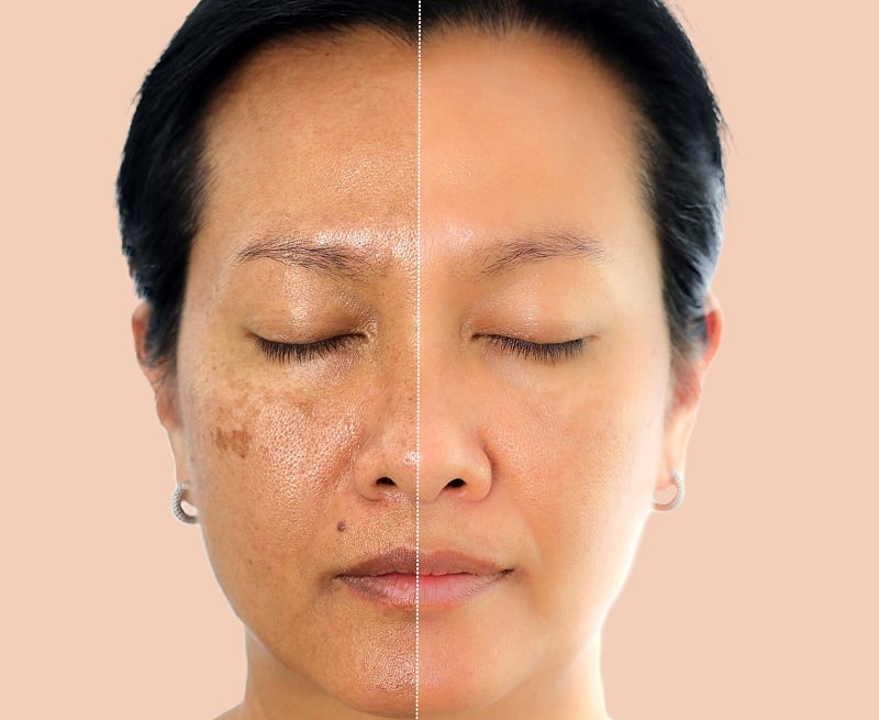 How-to-Protect-Your-Skin-moi