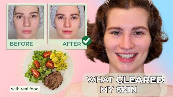 The Best Foods for Clear Skin